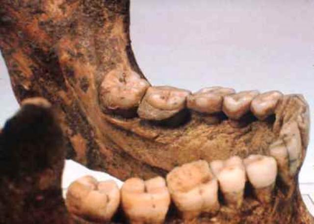 
      دیرینه شناسی انسان شناسی دندان