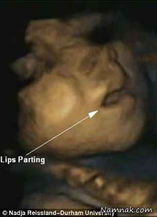 حرکت باورنکردنی جنین درون شکم مادرش + تصاویر