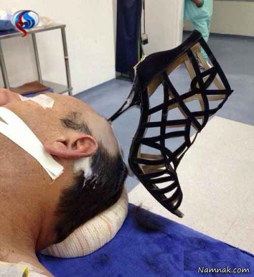 پاشنه کفش زن در سر شوهرش گیر کرد