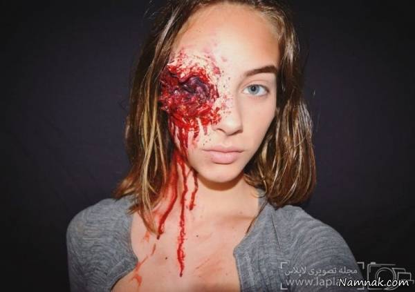 چهره وحشتناک دختر 15 ساله + تصاویر