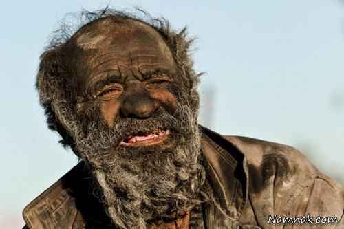 کثیف ترین مرد ایرانی/ عموحاجی 60 سال حمام نرفته!
