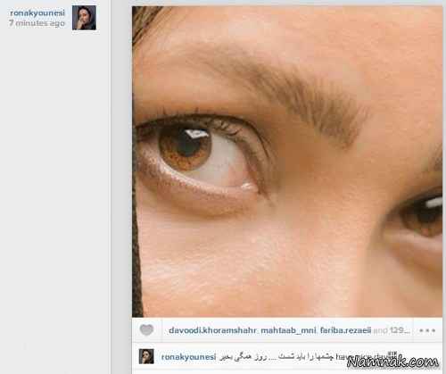 عکس جالب روناک یونسی از چشمانش + عکس