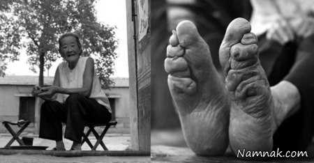 زنان چینی که کوچکترین پاهای دنیا را دارند + تصاویر