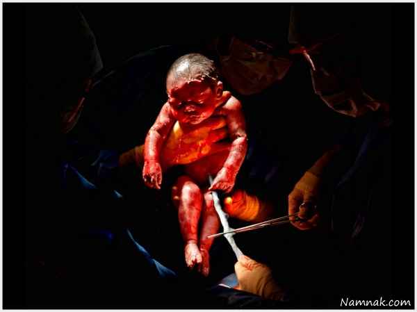 اولین تصاویر از لحظه تولد نوزاد انسان
