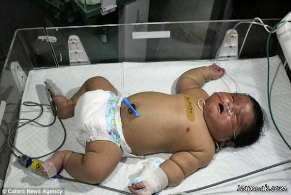 بچه غول زن هندی متولد شد + تصاویر