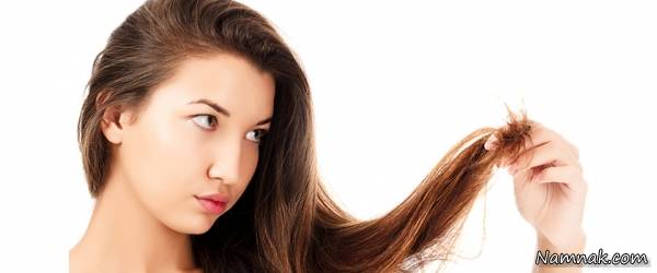 ریزش مو زنان و دختران جوان چطور درمان می شود؟