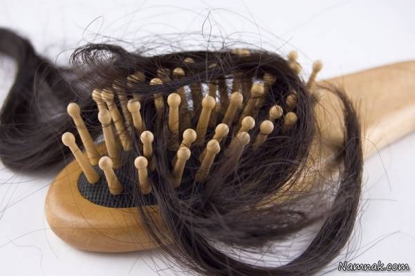ریزش مو زنان و دختران جوان چطور درمان می شود؟