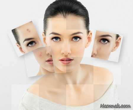 رازهای مهم طب سوزنی برای زیبایی پوست صورت
