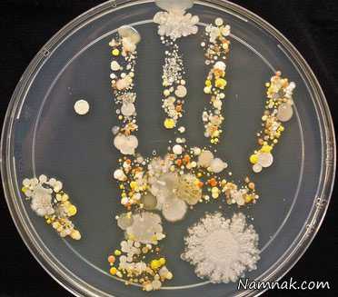 میکروب های دست|میکروب های کف دست خود را تا کنون دیده اید؟