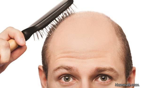 درمان ریزش مو با معجون جادویی در خانه + دستورالعمل