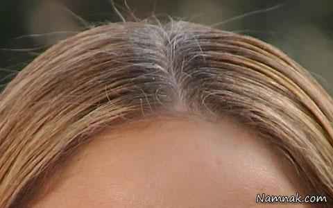 چگونه مانع سفید شدن مو شویم؟