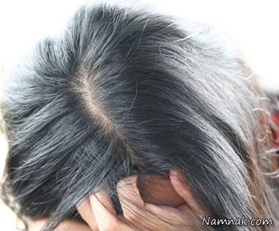 آیا استرس باعث سفیدی مو می شود؟