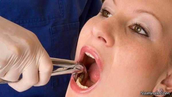 علت لق شدن دندان ها در بزرگسالی و درمان آن