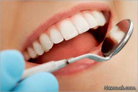 دندان|روش ساده پر کردن دندان بدون نیاز به دندانپزشک