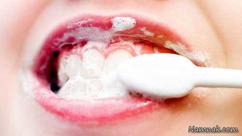 سفید کردن دندان با معجونی بهتر از هر خمیردندان
