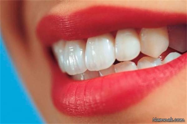 چه عواملی سبب پوسیدگی دندان می شود؟
