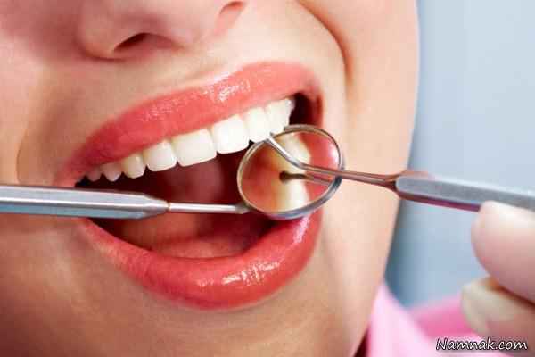 بیماری هایی که با معاینه دندان مشخص می شوند