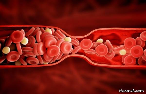 علائم لخته شدن خون در بدن