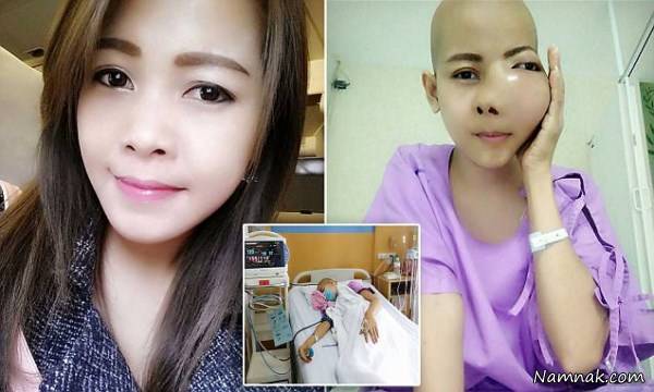 تومور دهان , آبسه لثه دختر جوان تومور سرطانی ازآب درآمد