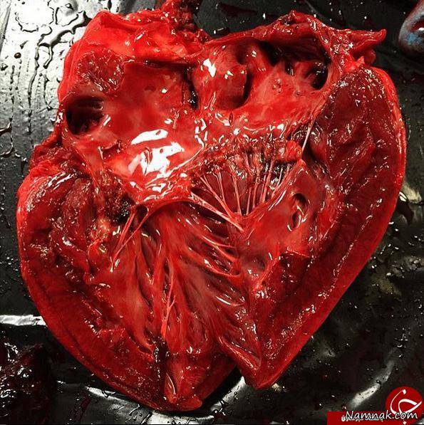 قلب انسان پس از مرگ از نمایی نزدیک + تصاویر