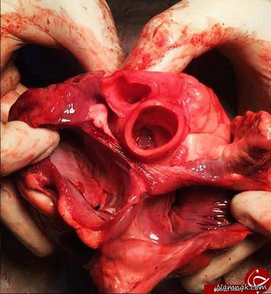 قلب انسان پس از مرگ از نمایی نزدیک + تصاویر