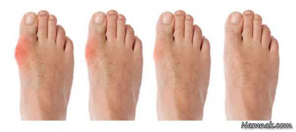 تشخیص بیماری ها از روی پاهایتان
