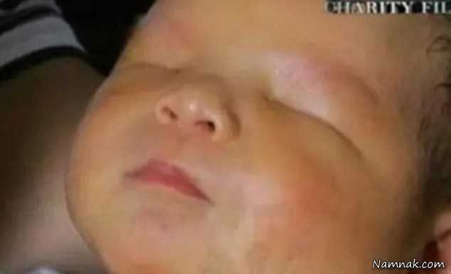 نوزاد عجیب , تولد نوزادی بدون چشم در چین +تصاویر