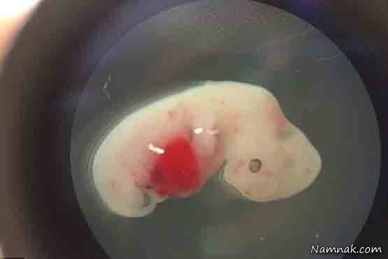 جنین |تشکیل جنین ترکیبی خوک و انسان برای اولین بار+ عکس