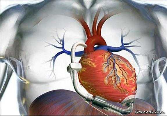 ساخت قلب مصنوعی با قابلیت پیوند به بیمار