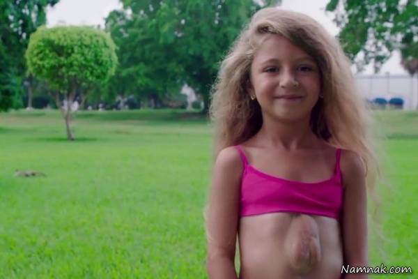 دختر 7 ساله که قلبش بیرون سینه می زند + تصاویر