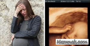تاثیر باورنکردنی گریه مادر بر جنین + عکس واکنش جنین