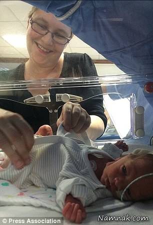 جراحی نوزادان دوقلو عجیب در شکم مادر+ تصاویر