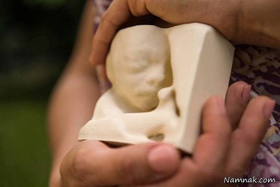 ساخت تصویر سه بعدی جنین برای مادران نابینا +تصاویر