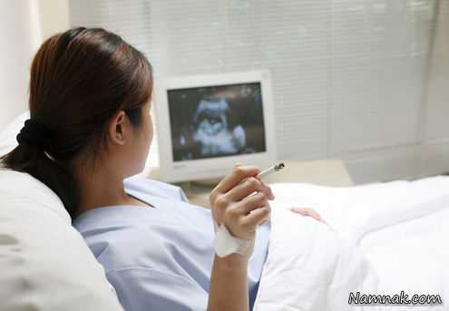 سیگار کشیدن در بارداری موجب کوتاهی قد جنین می شود؟