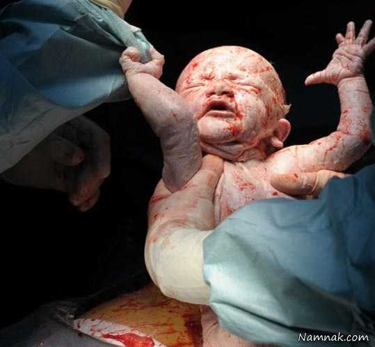 هنگام تولد نوزاد | آیا هنگام تولد نوزاد احساس درد می کند؟