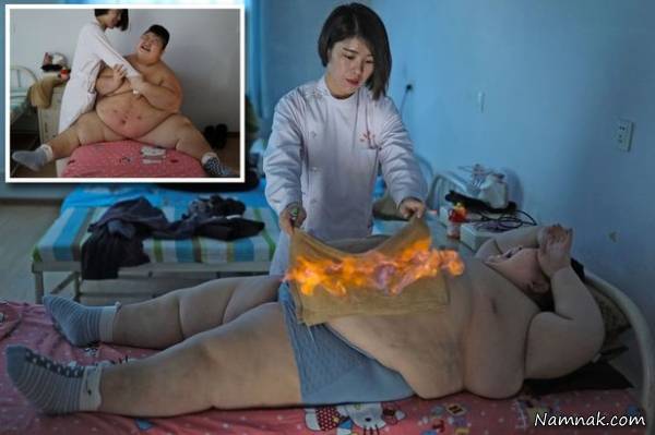 پسربچه 150 کیلویی برای لاغری سوزانده شد +تصاویر