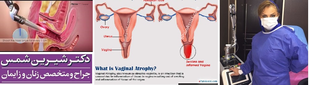 جراحی زیبایی واژن