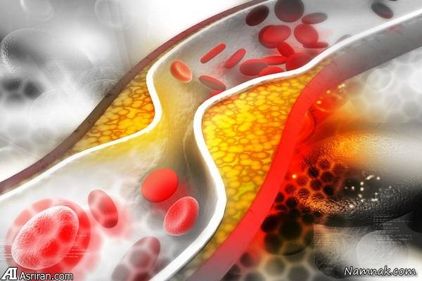 کلیدی ترین ترفندهای مدیریت کلسترول بالای خون