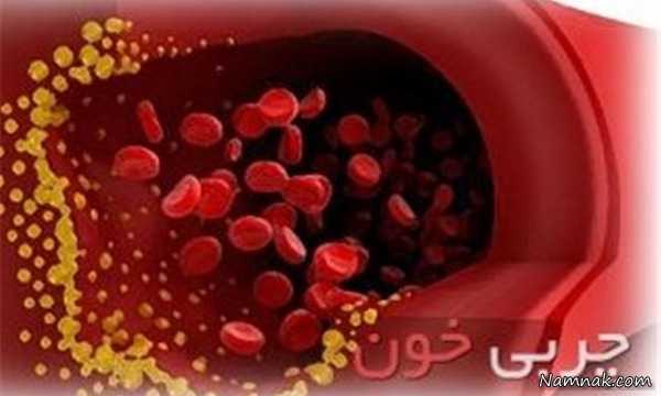 چربی خون | راههای کنترل چربی خون بدون مصرف دارو