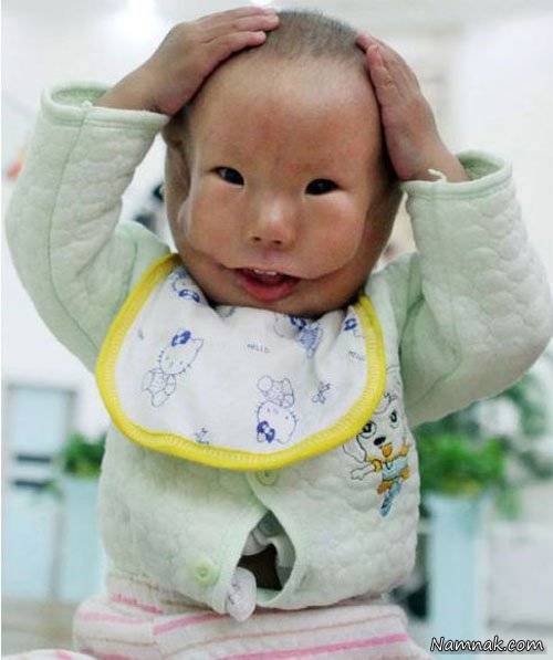 تولد نوزاد چینی با ماسک روی صورت! + عکس