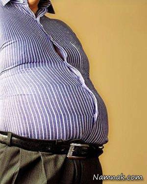 سایز شکم با بیماری کبد چرب ارتباط دارد