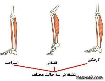 برای درمان گرفتگی عضلات چه کنیم