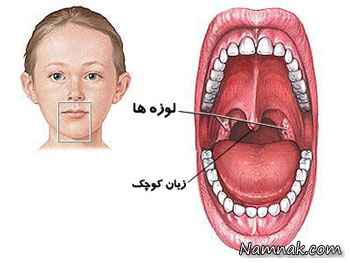 علت بزرگ شدن زبان کوچک