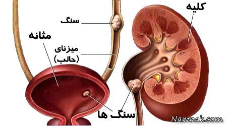 علت زیاد دستشویی رفتن چیست؟