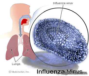 آنفولانزا|علائم آنفولانزا و درمان آن