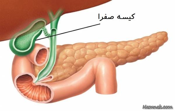 ساده ترین روش تشخیص سنگ کیسه صفرا