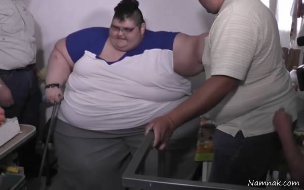 نصف شدن چاق ترین مرد جهان بعد از جراحی! + تصاویر
