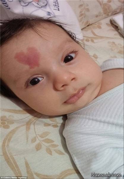 قلب روی پیشانی یک نوزاد! + عکس