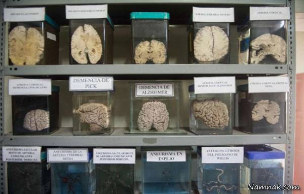 موزه عجیب از آثار ناهنجاری های مغز (تصاویر +14)