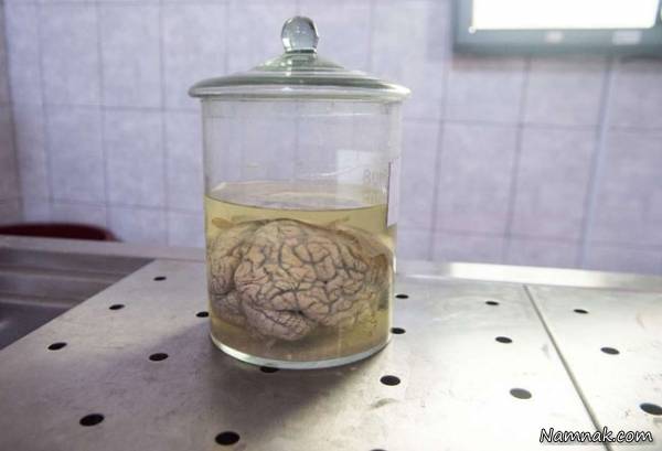 موزه عجیب از آثار ناهنجاری های مغز (تصاویر +14)